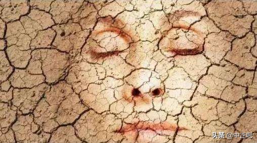 秋冬季节皮肤干燥发痒怎么办,秋冬皮肤干裂涂什么