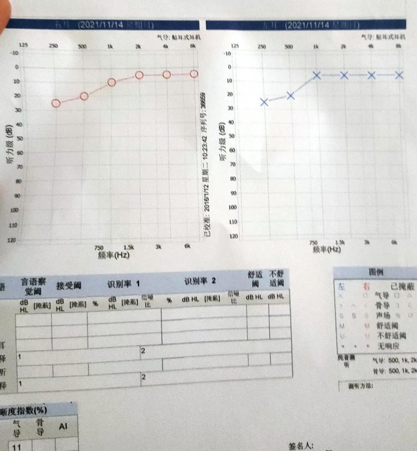 突发性耳聋住院需要人照顾吗,突发性耳聋住院大概费用是多少
