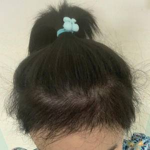 发际线太高怎么办,发际线太高怎么办做什么发型