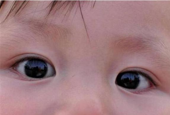 小孩把石灰弄到眼睛里了怎么办,3岁儿童眼睛误入石灰