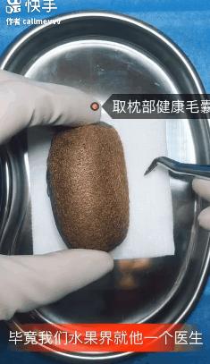 香蕉割包皮，洋葱剖腹产？这是我见过最秀的医生