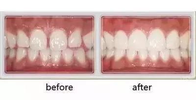 helen齿科黄璐,helen齿科