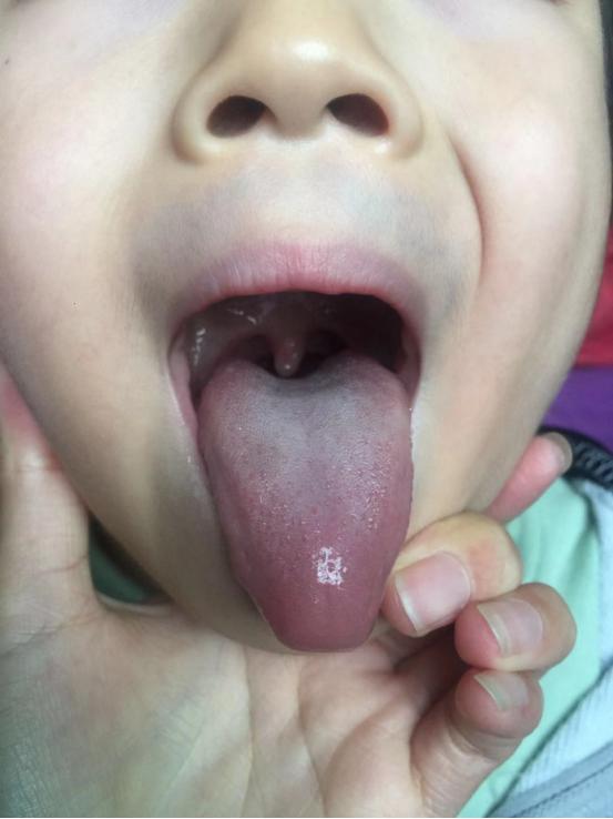 皮肤粗糙脾气燥,皮肤粗糙脾气暴躁