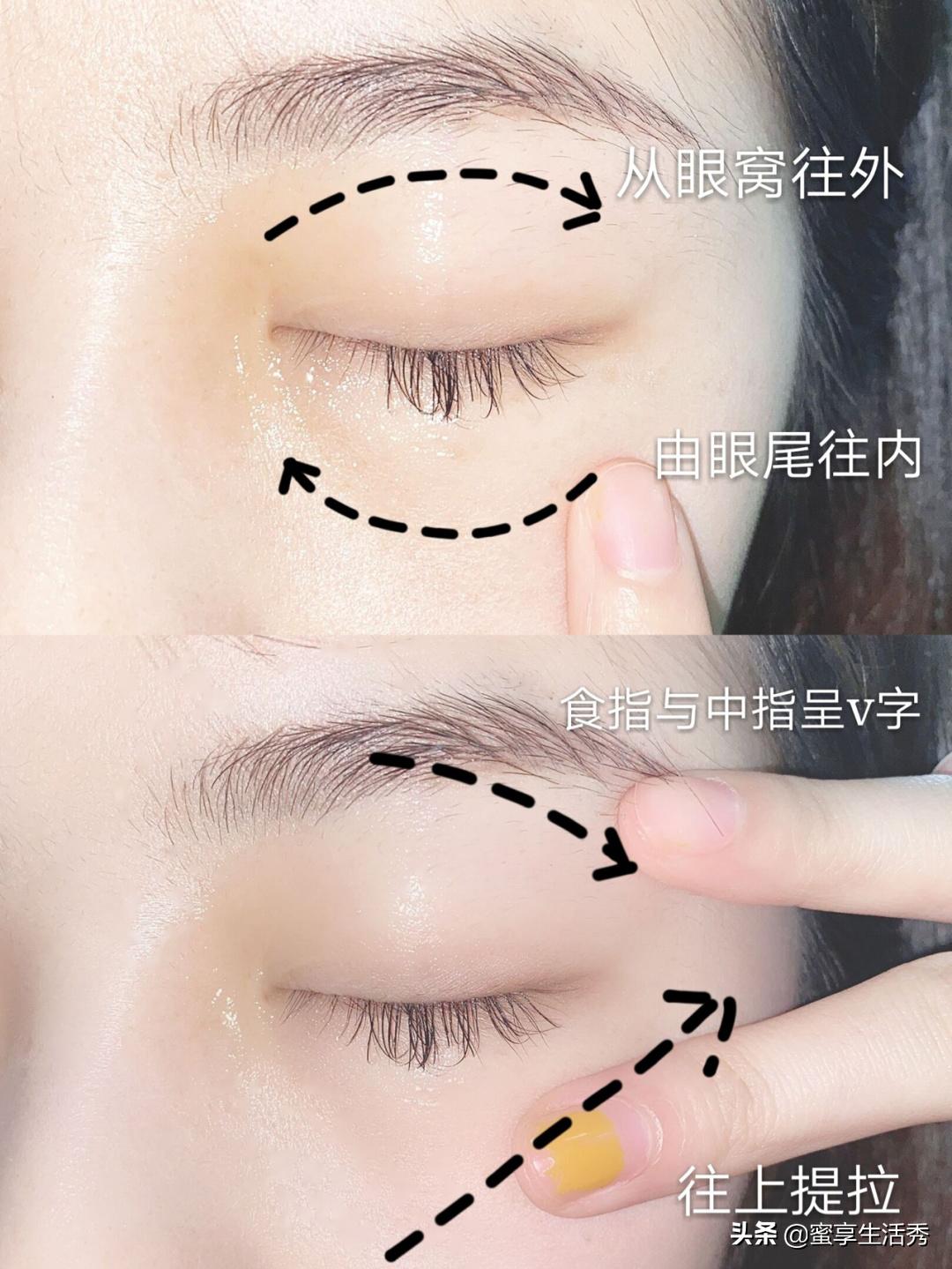 内双眼皮怎么变外双按摩最有效,内双眼皮手术变外双效果