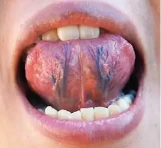 医生看舌头时怎么伸舌头,为什么医生总是伸舌头