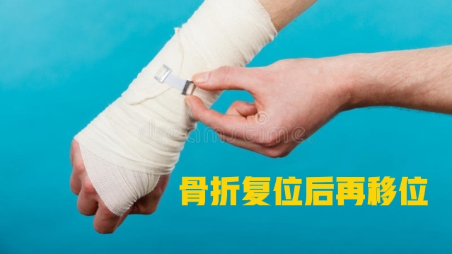 骨折复位后又移位有什么症状,骨折手法复位后容易移位吗