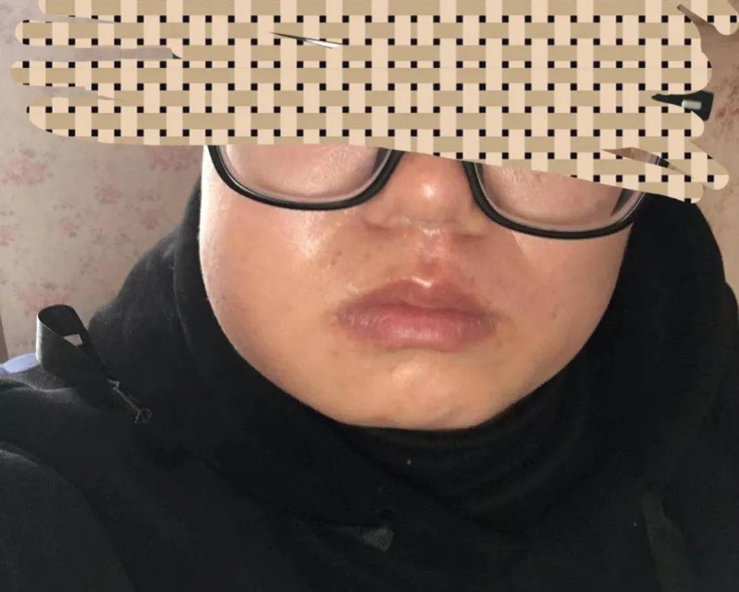 不要轻易去医院,为什么不建议去急诊科