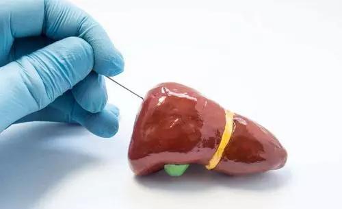 肝穿刺是穿刺好的肝吗,肝穿刺是活检么