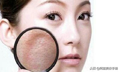 改善毛孔粗大小妙招,拯救毛孔粗大的四个方法