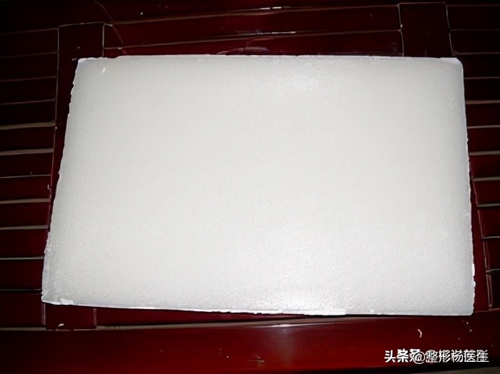 隆鼻整容老了会怎么样,隆鼻后老了