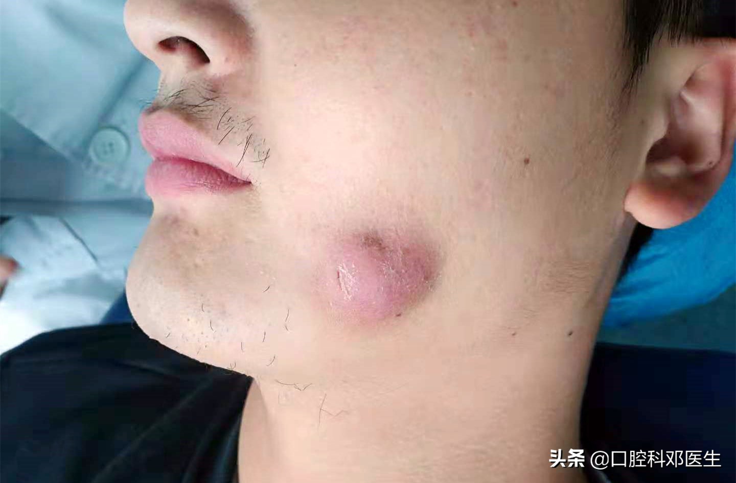 不要让牙齿毁了你的五官,别让一颗牙毁一口牙