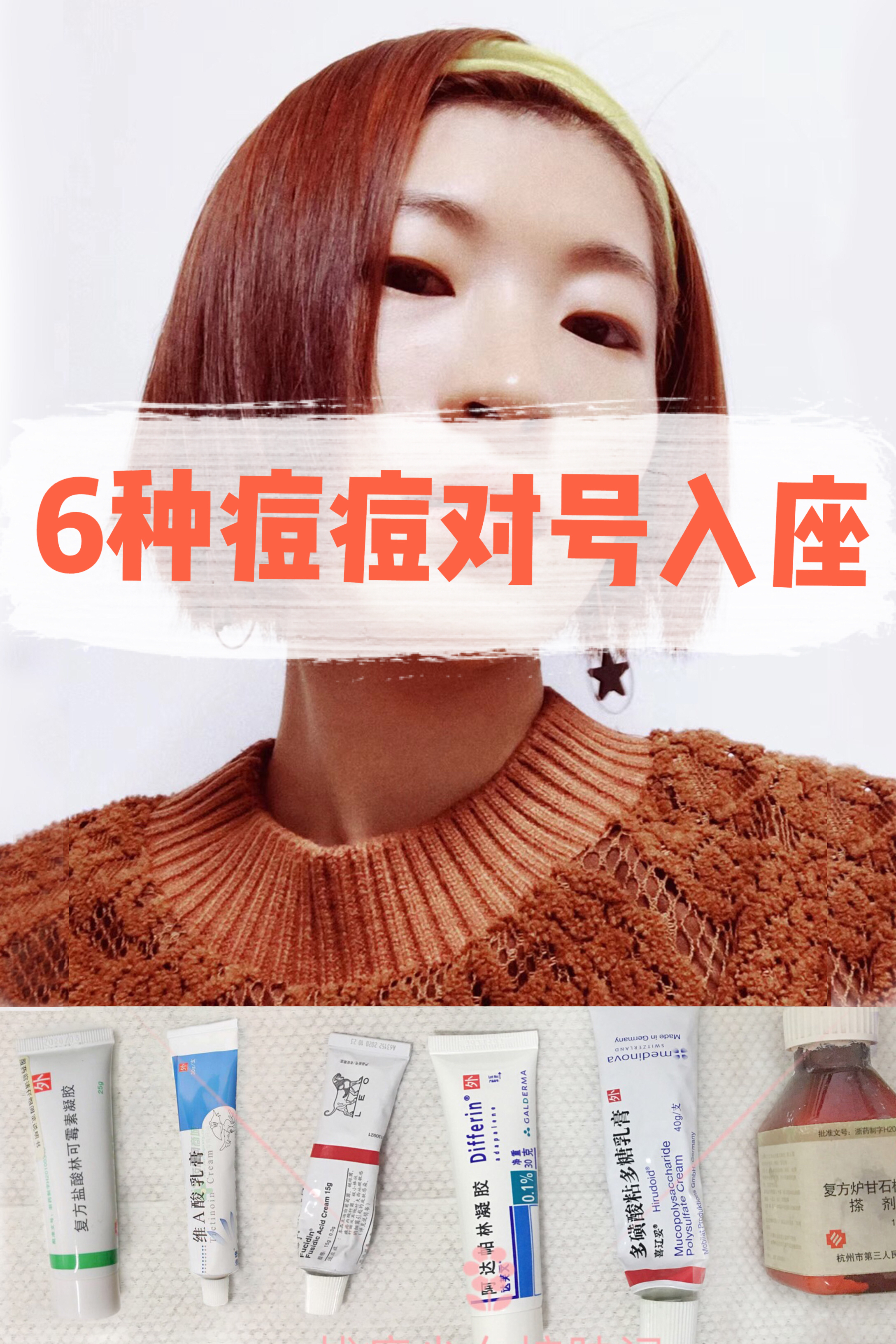 四种痘痘最佳治疗方法,各种痘痘的对症用药