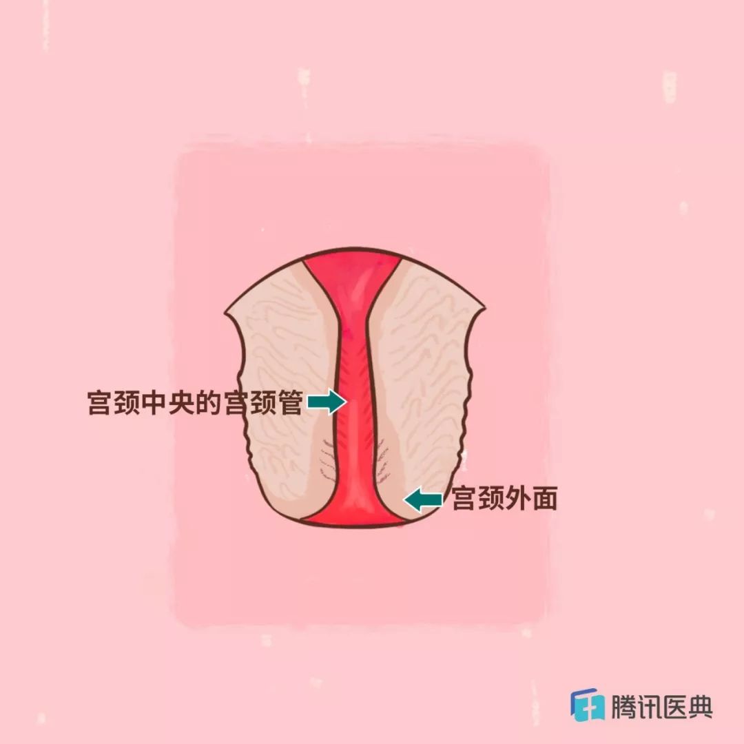 没错，这个所谓“妇科病”，应该改一下名字了