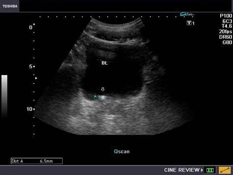 我老太,老太夜尿多怎么办