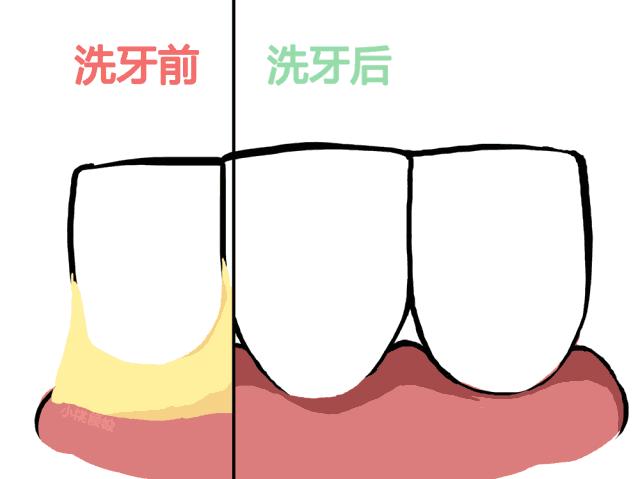 想要牙齿美白这三招最管用,想要美白牙齿让牙齿更健康