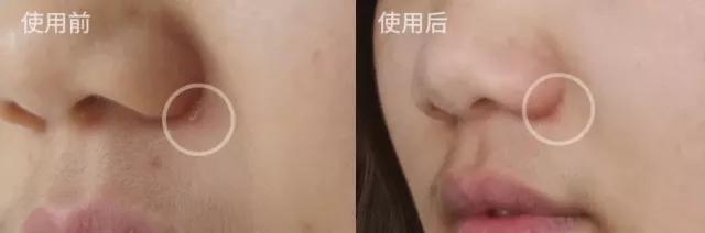 超临界蜂胶与普通蜂胶有几大优点,纯天然蜂胶的作用与功效