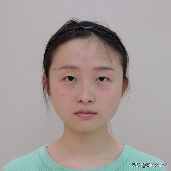 长期贴双眼皮的危害,贴几次双眼皮贴会导致眼皮松弛