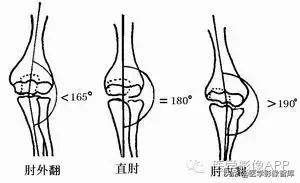 肘关节x线测量,肘关节骨骺示意图