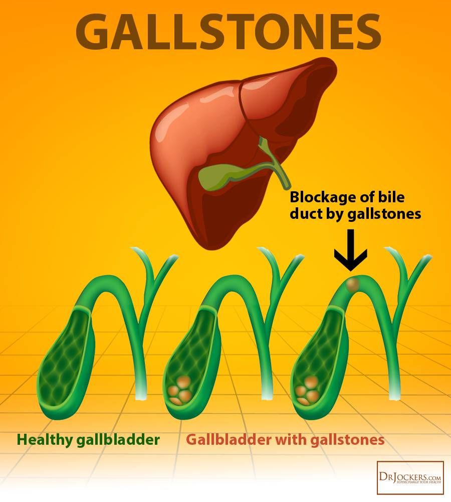 蔡志忠一天只吃一顿饭不生病,蔡志忠46天不吃饭
