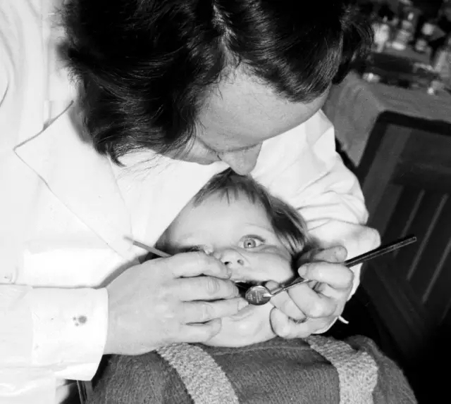 以前是怎么拔牙的,以前拔牙怎么拔的