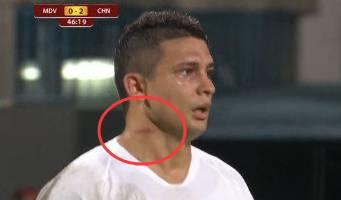 埃尔克森在亚冠赛场最精彩的进球,埃尔克森精彩进球