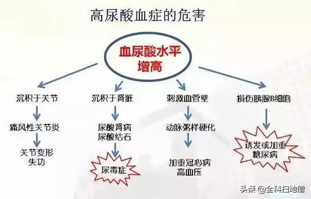 非布司他降尿酸，何时用？何时停？用多少？