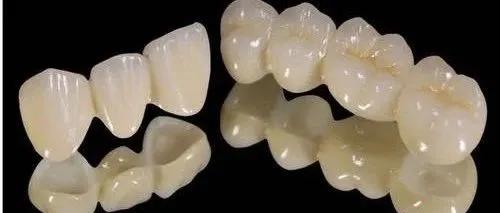 二氧化锆假牙可以做核磁吗,拿不掉的假牙可以做核磁共振么