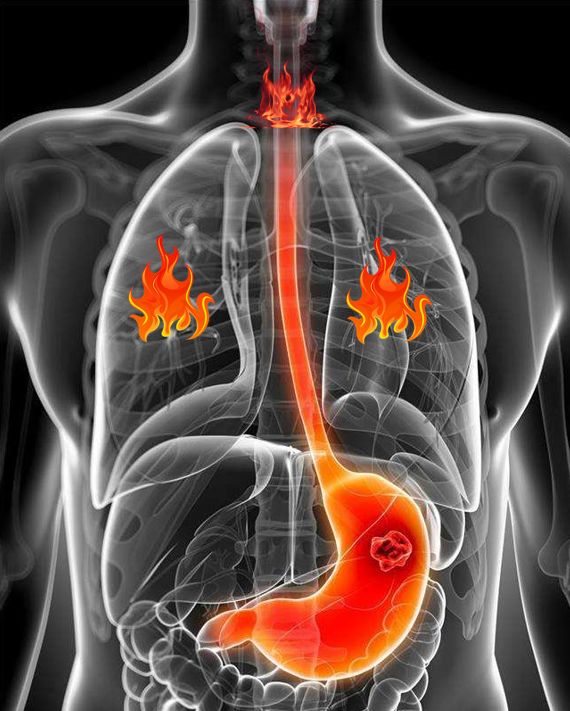 小孩易上火体质最根本的原因,脾胃虚寒的孩子上火怎么办