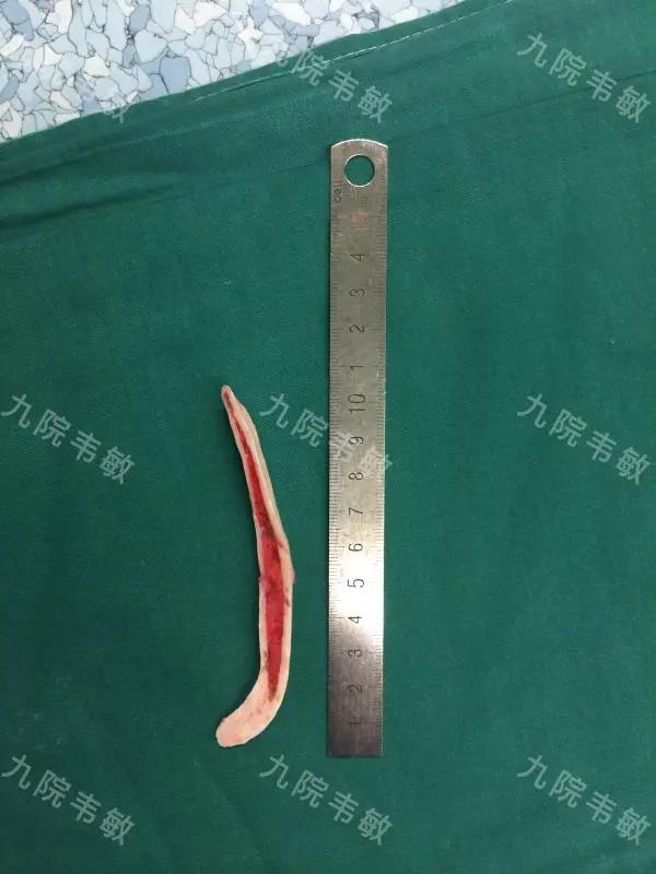 不想做正颌手术怎么改善嘴突,脸不对称挂号正畸还是正颌