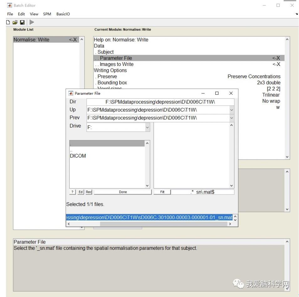 脑功能报告解读,颅脑mri信号讲解视频教程