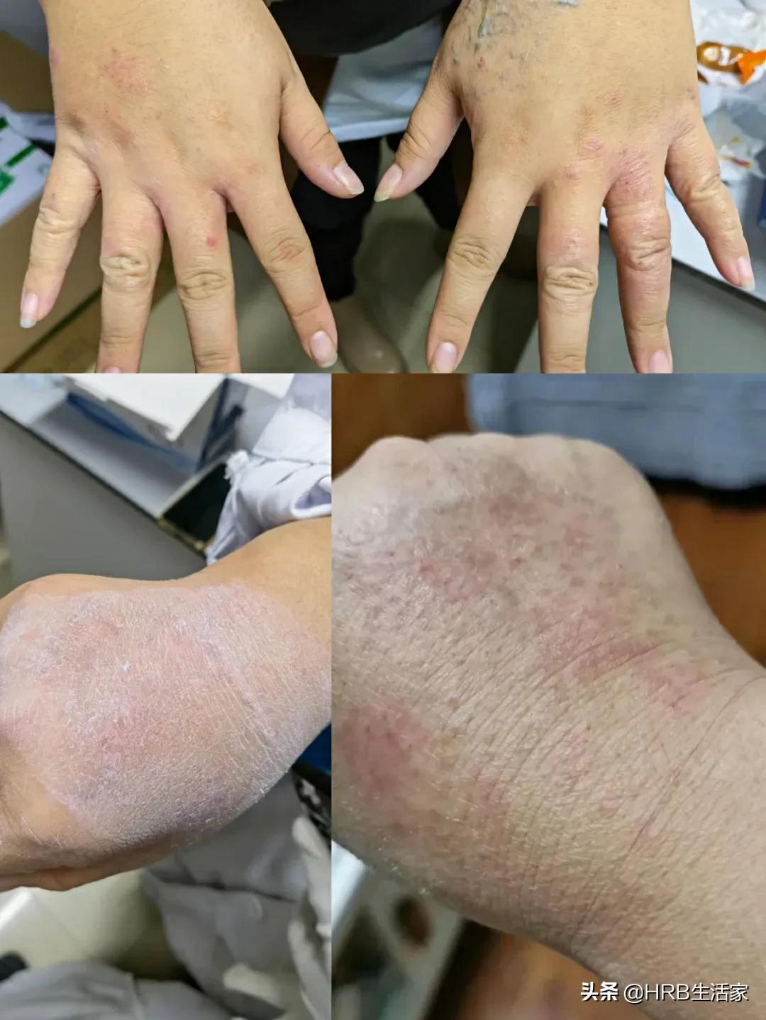 月圆日疫情来袭同战疫只争朝夕最美的“大白”——记哈市道外区人民医院大兴、南直社区核酸检测入户采样团队