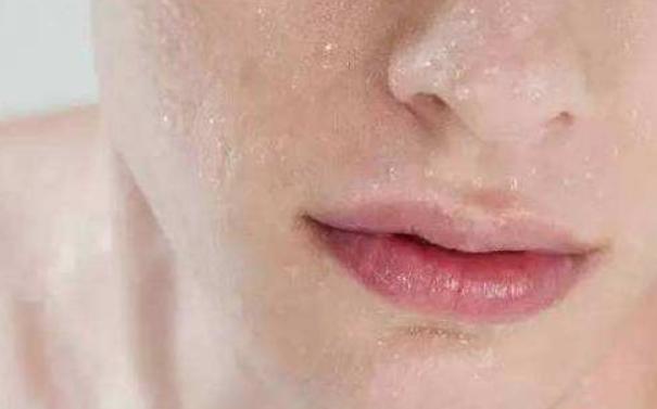 只有润唇膏如何迅速缓解嘴唇起皮,为什么每天涂唇膏都会起皮