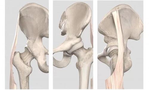 健身引起的膝盖疼解决方法,健身如何缓解对膝盖损伤
