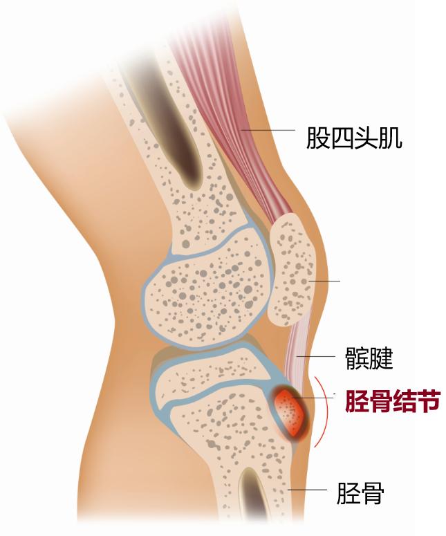13岁一天跳绳1000个可以长高吗,14岁长高跳绳每天跳几下