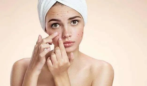 脸过敏干燥起皮紧绷发红怎么修复,换季皮肤过敏起皮用什么药