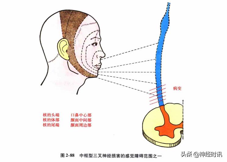 脑干解剖,脑干神经解剖