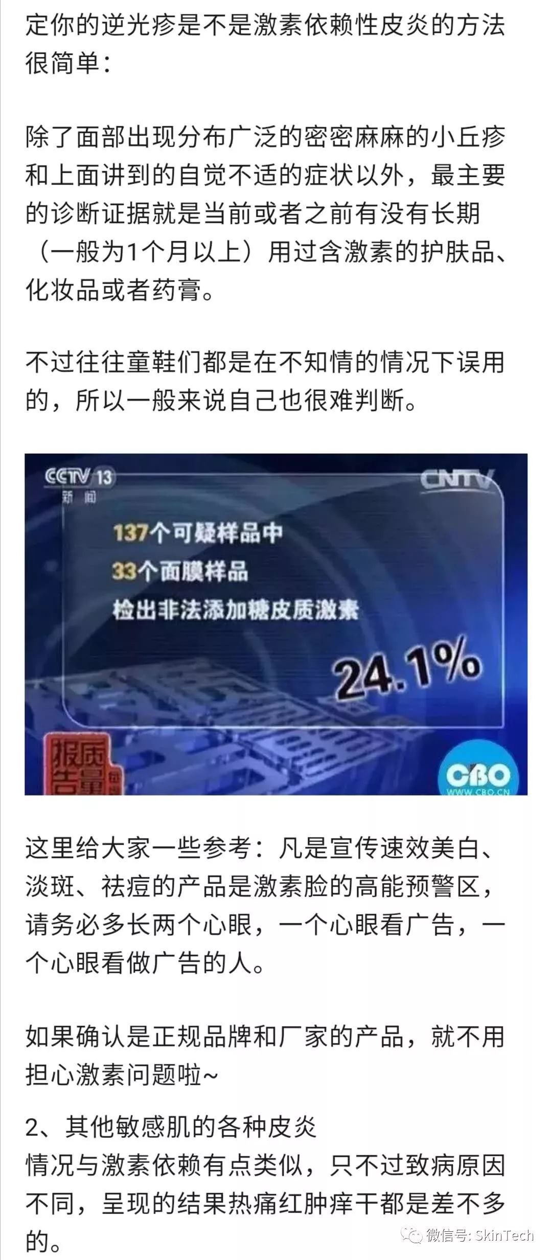 逆光疹是属于皮肤炎症吗,逆光疹是不是日光性皮炎