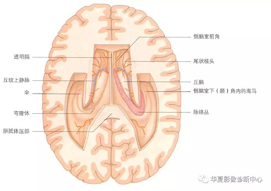 透明隔腔与透明囊肿鉴别,透明隔间腔与囊肿区别