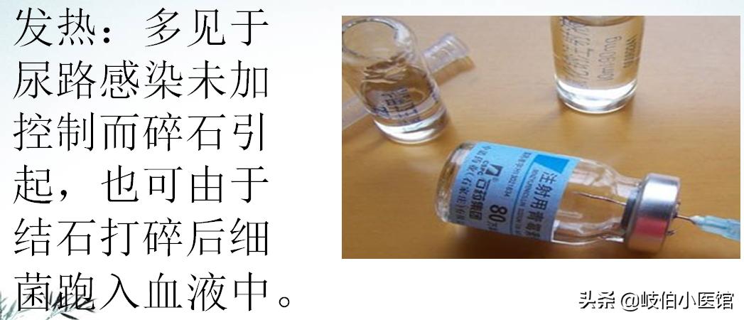 输尿管5mm结石体外冲击波碎石危害,体外冲击波碎石后尿出结石