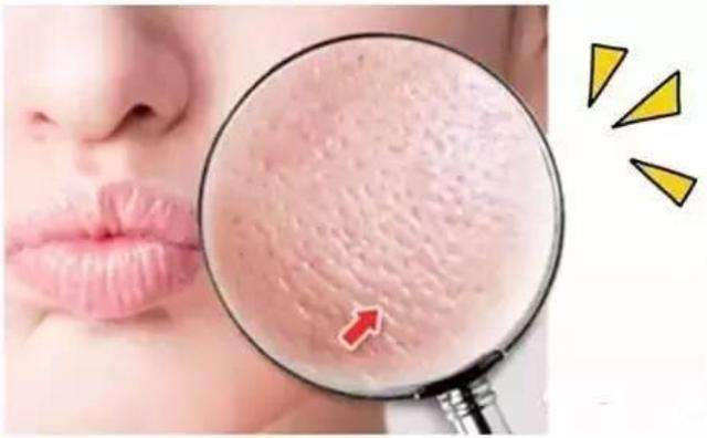 毛孔粗大怎么办教你一招,毛孔粗大怎么办护肤步骤