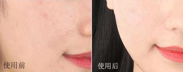 敏感肌换季好物,敏感肌水乳抗皱天花板