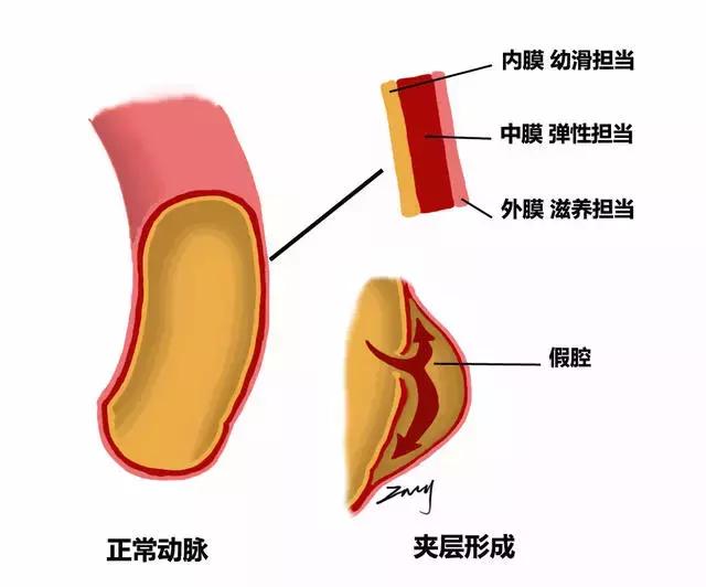 高危胸痛和低危胸痛鉴别,急性胸痛诊断和高危胸痛识别