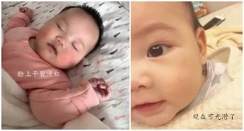 2岁宝宝脸发黄还有皮肤不均匀,宝宝快两岁了宝妈脸上有斑