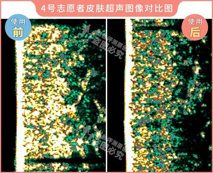 300块的网红美容仪有效果吗,网红家用美容仪测评