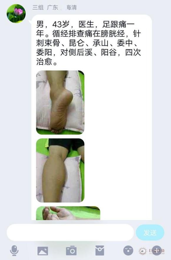 足跟痛是肾阴虚还是阳虚如何判断,气血不够会导致足跟痛吗