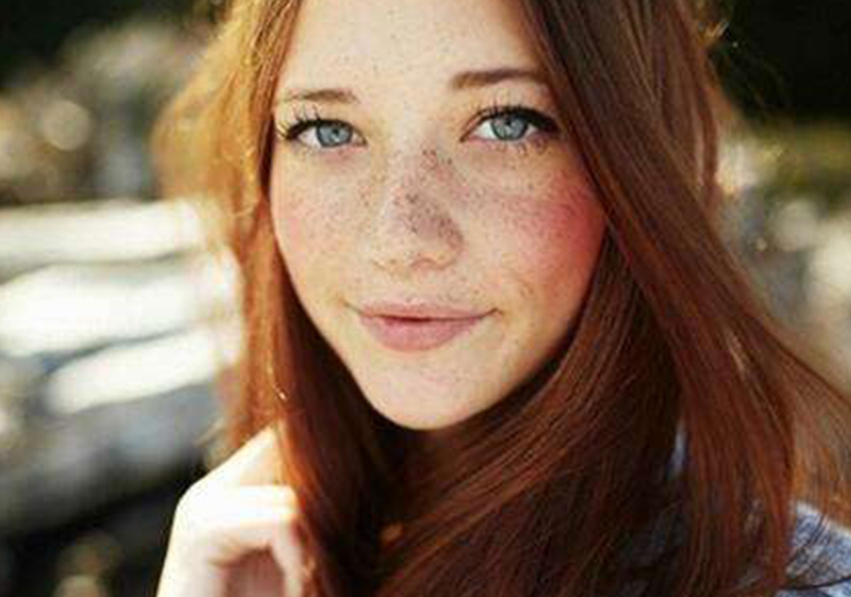 脸上有斑和手上有斑怎么回事,怎样知道自己脸上的斑是哪种斑