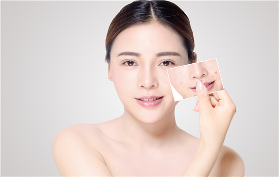 角质层薄如何正确修复,角质层薄怎么修复最有效