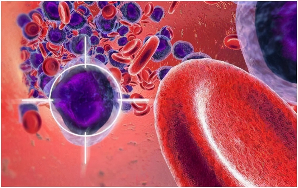 白血病复发女,白血病女孩骨髓复发