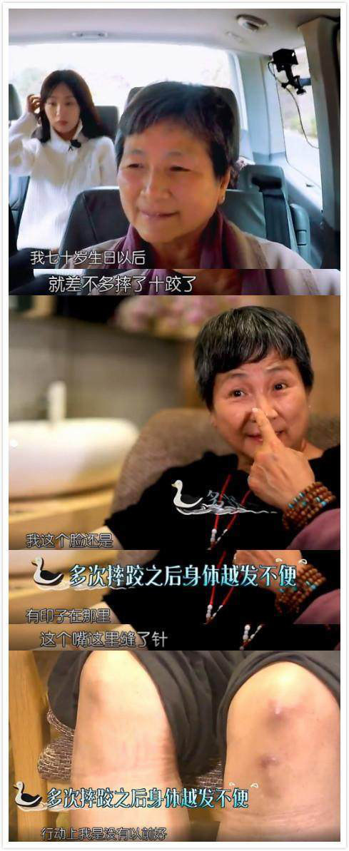 老人摔倒后进icu还有救吗,老人家摔跤骨折为什么住icu