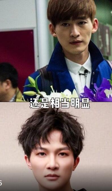 美妆网红晒华晨宇变脸过程质疑其做了3项整容手术，真的不怕被告